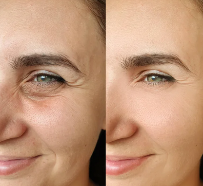 Coffret Skin Perfector